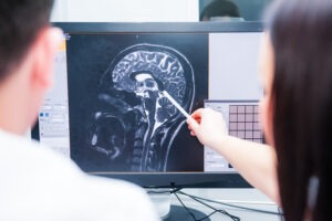 Oklahoma Traumatic Brain Injury Attorney