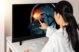 female doctor touching x-ray screen of brain